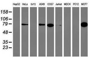 Image no. 1 for anti-phosphofructokinase, Platelet (PFKP) antibody (ABIN1500166) (PFKP Antikörper)