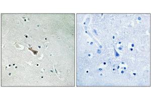 Immunohistochemical analysis of paraffin-embedded human brain tissue using APLP2 (Phospho-Tyr755) antibody (left)or the same antibody preincubated with blocking peptide (right). (APLP2 Antikörper  (pTyr755))