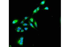 Immunofluorescence staining of Hela cells with ABIN7172251 at 1:100, counter-stained with DAPI. (TNIP1 Antikörper  (AA 526-636))