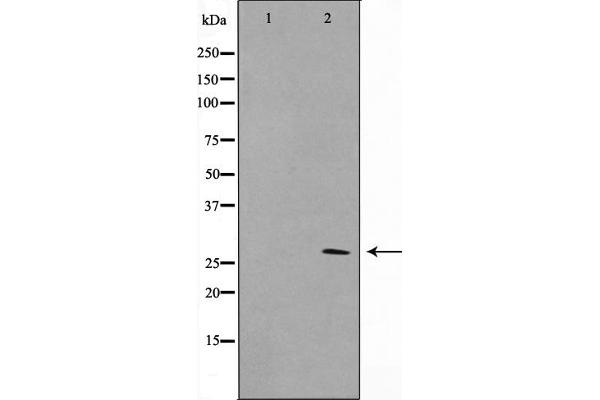 KDELR3 Antikörper  (Internal Region)