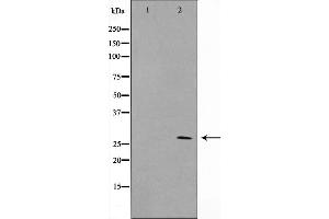 Western blot analysis on NIH-3T3 cell lysate using ERD23 Antibody (KDELR3 Antikörper  (Internal Region))