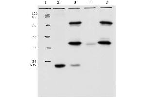 IP analysis of HPV-11 E7 protein. (Human Papilloma Virus 11 E7 (HPV-11 E7) (AA 36-70) Antikörper)