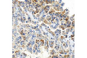 anti-Claudin 3 (CLDN3) (C-Term) antibody