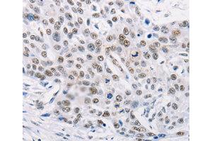 Immunohistochemistry (IHC) image for anti-Tripartite Motif Containing 63 (TRIM63) antibody (ABIN1875209) (TRIM63 Antikörper)