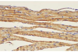 Immunohistochemistry of paraffin-embedded Mouse heart using CD146 Ployclonal Antibody at dilution of 1:50. (MCAM Antikörper)