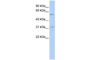 WB Suggested Anti-BTBD14B Antibody Titration:  0. (NAC1 Antikörper  (Middle Region))