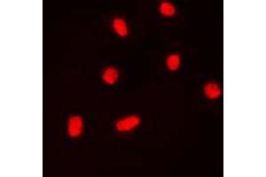 Immunofluorescent analysis of BAF53A staining in K562 cells. (BAF53A Antikörper  (Center))
