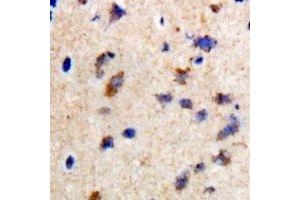 Immunohistochemical analysis of CCDC52 staining in rat brain formalin fixed paraffin embedded tissue section. (SPICE1 Antikörper)