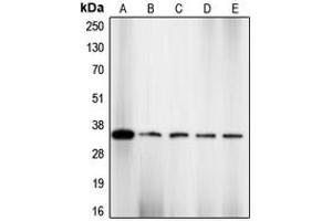 Western blot analysis of CDK2 (pT160) expression in NIH3T3 (A), HeLa (B), COLO205 (C), K562 (D), A2780 (E) whole cell lysates. (CDK2 Antikörper  (pSer160))