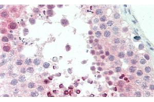 Immunohistochemistry (IHC) image for anti-Cyclin-Dependent Kinase Inhibitor 2D (p19, Inhibits CDK4) (CDKN2D) (AA 1-166) antibody (ABIN7445231)