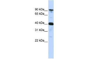 Western Blotting (WB) image for anti-Cysteinyl-tRNA Synthetase (CARS) antibody (ABIN2458484) (CARS Antikörper)