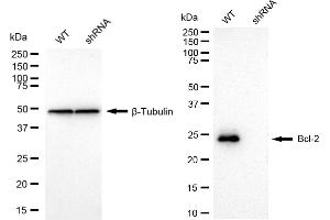 Western blotting analysis using Bcl-2 antibody (ABIN7797718). (Rekombinanter Bcl-2 Antikörper)