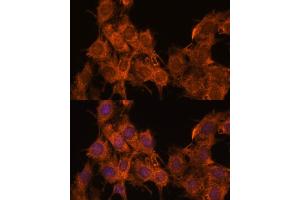 Immunofluorescence analysis of C6 cells using SNX15 antibody  at dilution of 1:100. (SNX15 Antikörper  (AA 1-342))