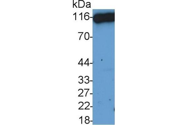 DPP4 Antikörper  (AA 29-178)