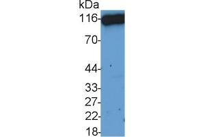 Detection of CD26 in HepG2 cell lysate using Polyclonal Antibody to Cluster Of Differentiation 26 (CD26) (DPP4 Antikörper  (AA 29-178))