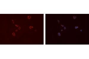 Immunofluorescence (fixed cells) (IF/ICC) image for anti-Fc Fragment of IgG, Low Affinity IIa, Receptor (CD32) (FCGR2A) (C-Term) antibody (ABIN6261701)