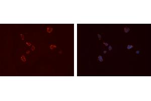 ABIN6276667 staining Hela cells by IF/ICC. (FCGR2A Antikörper  (C-Term))