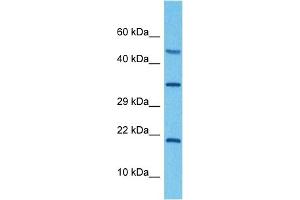 Host:  Rabbit  Target Name:  ATP6V0C  Sample Tissue:  Human RPMI 8226 Whole Cell  Antibody Dilution:  1ug/ml