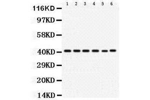 Western Blotting (WB) image for anti-Chemokine (C-X-C Motif) Receptor 2 (CXCR2) (AA 196-212), (Middle Region) antibody (ABIN3043018) (CXCR2 Antikörper  (Middle Region))