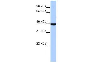 WB Suggested Anti-PAX2 Antibody Titration:  1. (PAX2A Antikörper  (Middle Region))