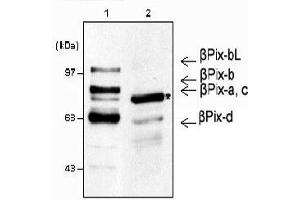Western blot analysis using anti-β-Pix (mouse), pAb . (ARHGEF7 Antikörper)