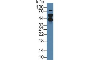 Western blot analysis of Human Lung lysate, using Rabbit Anti-Human TMPO Antibody (1 µg/ml) and HRP-conjugated Goat Anti-Rabbit antibody (abx400043, 0.