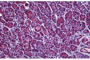 Human Pancreas: Formalin-Fixed, Paraffin-Embedded (FFPE) (Ataxin 1 Antikörper  (AA 742-791))