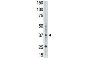 EPR1 antibody used in western blot to detect EPR1 in HL-60 cell lysate (EPR1 Antikörper  (AA 308-337))