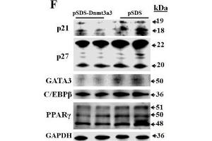 Dnmt3a3 overexpression decreases fat accumulation in differentiating preadipocytes. (CDKN1B Antikörper  (AA 150-198))