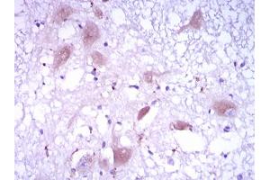 Image no. 1 for anti-DKK3 antibody (ABIN1491710) (DKK3 Antikörper)