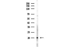 anti-Ribonuclease P/MRP 25 Subunit-Like (RPP25L) (C-Term) antibody