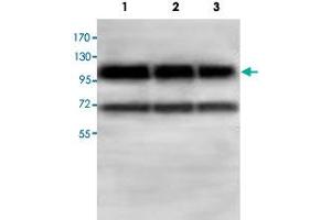 Western blot analysis of HepG2 (Lane 1) and 293T (Lane 2) and HeLa cell lysates with ABCF1 polyclonal antibody  at 1 : 500 dilution. (ABCF1 Antikörper  (AA 580-837))