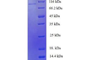 SDS-PAGE (SDS) image for Zinc Finger Protein 175 (ZNF175) (AA 1-711), (full length) protein (His-SUMO Tag) (ABIN5710648) (ZNF175 Protein (AA 1-711, full length) (His-SUMO Tag))