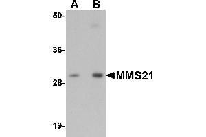 Western blot analysis of MMS21 in 293 cell lysate with MMS21 antibody at (A) 0.