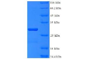 SDS-PAGE (SDS) image for Polymerase (RNA) III (DNA Directed) Polypeptide K, 12.3 KDa (POLR3K) (AA 1-108), (full length) protein (His-SUMO Tag) (ABIN5710125) (POLR3K Protein (AA 1-108, full length) (His-SUMO Tag))