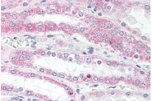 Human Kidney (formalin-fixed, paraffin-embedded) stained with VAMP5 antibody ABIN337073 at 10 ug/ml followed by biotinylated goat anti-rabbit IgG secondary antibody ABIN481713, alkaline phosphatase-streptavidin and chromogen. (VAMP5 Antikörper  (N-Term))