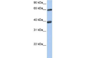 WB Suggested Anti-TKT Antibody Titration:  0.