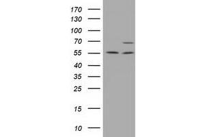 Western Blotting (WB) image for anti-Membrane Protein, Palmitoylated 3 (MAGUK P55 Subfamily Member 3) (MPP3) antibody (ABIN1499548) (MPP3 Antikörper)
