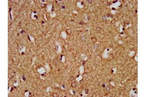 IHC image of ABIN7154814 diluted at 1:200 and staining in paraffin-embedded human brain tissue performed on a Leica BondTM system. (HEY1 Antikörper  (AA 200-300))