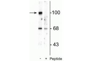 Western blot of rat brain lysate showing specific immunolabeling of the ~100 kDa GluR2 protein phosphorylated at Ser880 in the first lane (-). (GRIA2 Antikörper  (pSer880))