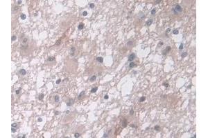 Immunohistochemistry (IHC) image for anti-Carboxypeptidase A4 (CPA4) (AA 55-421) antibody (ABIN7435982)