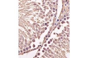 Immunohistochemical analysis of paraffin-embedded M. (Cyclin B1 Antikörper  (AA 103-130))