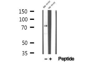 Western blot analysis of extracts of SH-SY5Y cells, using MECP2 antibody. (MECP2 Antikörper  (C-Term))