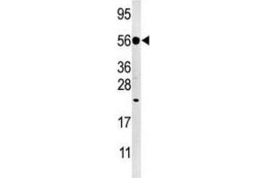 Western Blotting (WB) image for anti-Dual Specificity Phosphatase 8 (DUSP8) antibody (ABIN3003767) (DUSP8 Antikörper)