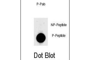Dot Blot (DB) image for anti-Lin-28 Homolog A (C. Elegans) (LIN28A) (pSer134) antibody (ABIN3001930) (LIN28A Antikörper  (pSer134))