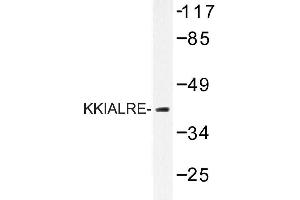 Image no. 1 for anti-Cyclin-Dependent Kinase-Like 1 (CDC2-Related Kinase) (CDKL1) antibody (ABIN272207) (CDKL1 Antikörper)