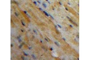 Used in DAB staining on fromalin fixed paraffin-embedded Heart tissue (MFAP5 Antikörper  (AA 25-152))