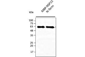Western Blotting (WB) image for anti-SARS-CoV-2 Uridylate-Specific Endoribonuclease (NSP15) (N-Term) antibody (ABIN7273007) (SARS-CoV-2 NSP15 Antikörper  (N-Term))