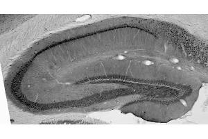 anti-ChaC, Cation Transport Regulator Homolog 1 (CHAC1) (AA 1-222) antibody