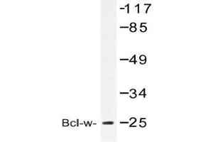 Western blot (WB) analysis of Bcl-w antibody in extracts from COLO cell (BCL2L2 Antikörper)